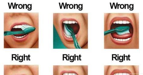 Natural Teeth Whitening Diy, Teeth Brushing, Brushing Your Teeth, Jessica Smith, Teeth Whitening Diy, Teeth Bleaching, Teeth Braces, Brush Your Teeth, Best Teeth Whitening