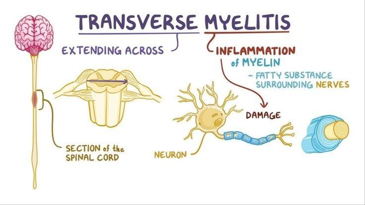 a diagram showing the different types of nervous systems