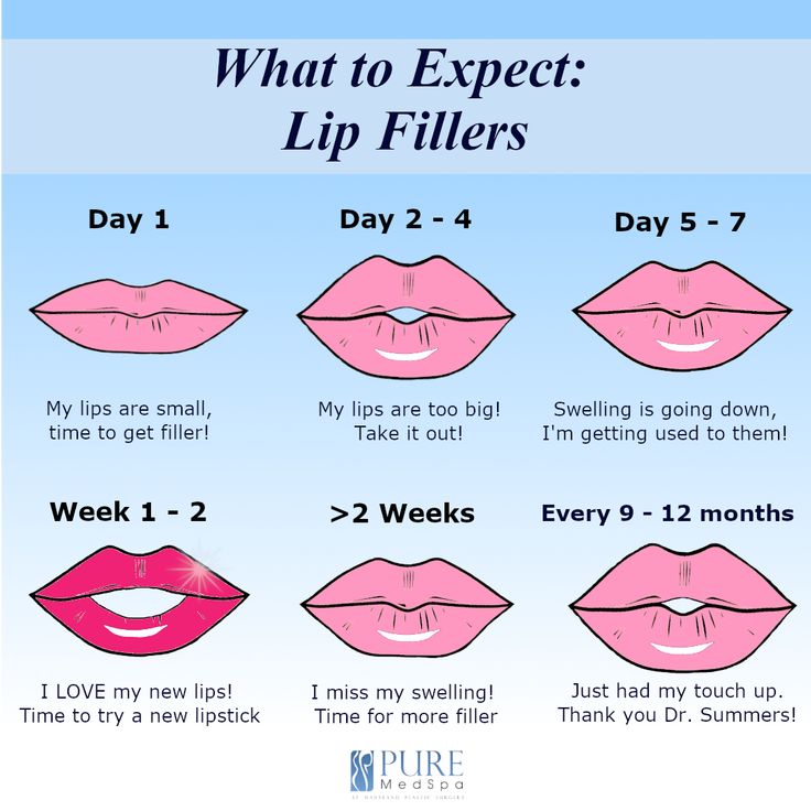 how to expect lip fillers for every day in the morning and evening, with instructions