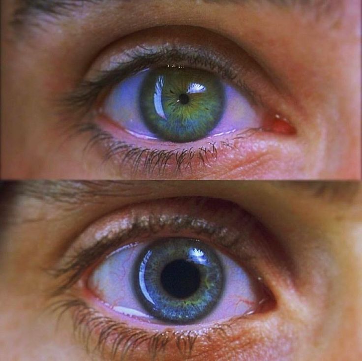 two different pictures of the same person's eye with blue and green colored eyes