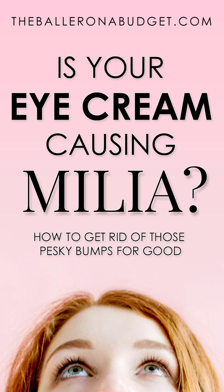 Do you have tiny bumps around your eyes that don’t seem to go away? They’re not pimples - they’re milia. And they might be caused by your eye cream. Heres how to get rid of those pesky bumps for good. White Bump On Eyelid, Bumps Under Eyes, Blind Pimple, Forehead Acne, Pimples Under The Skin, Skin Bumps, Prevent Pimples, How To Get Rid Of Pimples, Natural Sleep Remedies