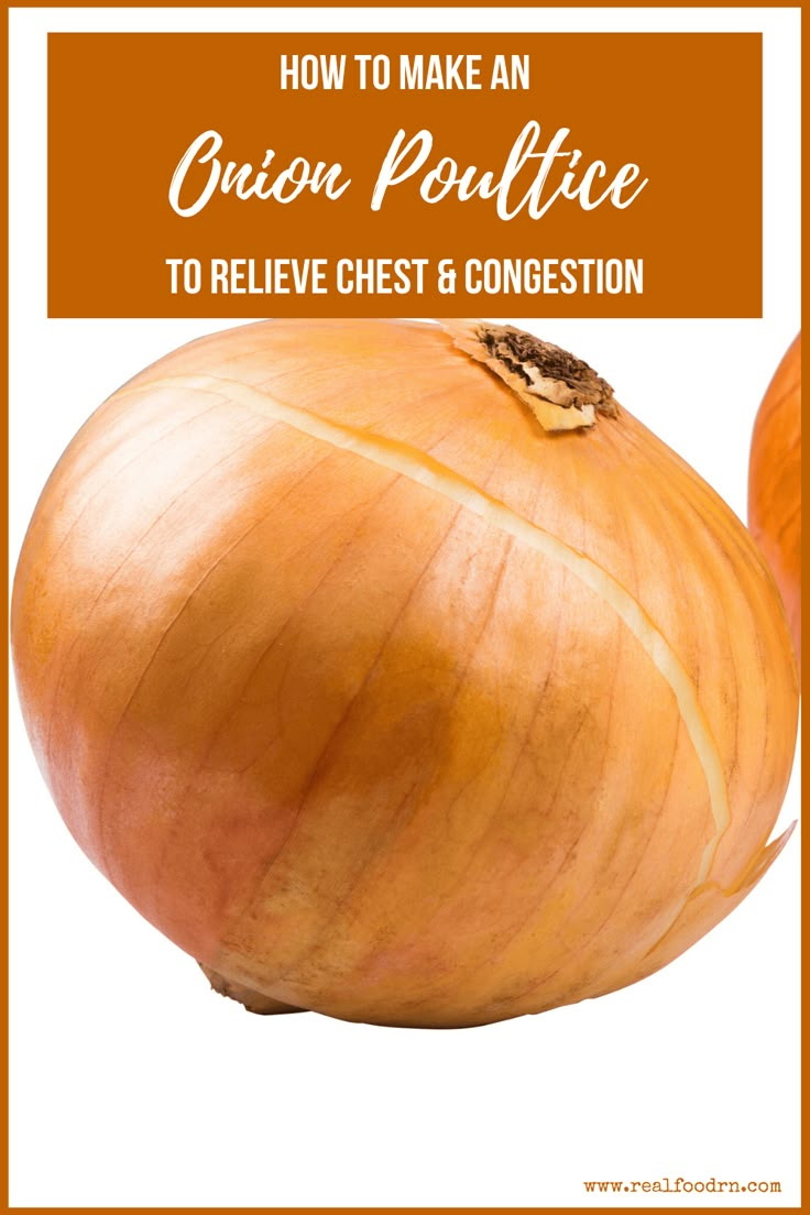 Onion Poultice, Remedies For Congestion, Cough Remedies For Kids, Natural Remedies For Congestion, Chest Congestion Remedies, Congestion Remedies, Best Cough Remedy, Sickness Remedies, Cold And Cough Remedies