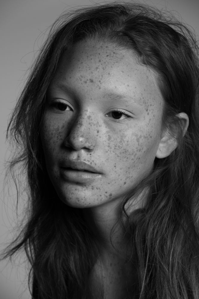 a black and white photo of a woman with freckles on her face