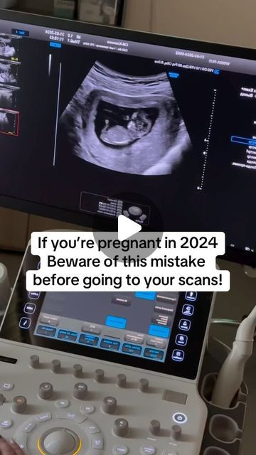 someone is looking at an x - ray in front of a computer screen that says, if you're pregnant in 2024 beware of this mistake before going to your scans