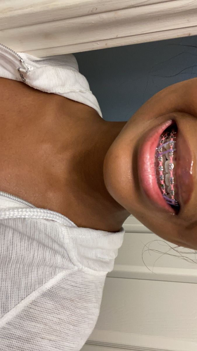 Pink braces black girls Black Powerchain Braces Colors, Braces Vision Board, Braces Colors On Black Women, Braces Ideas Cute, Hot Pink Power Chain Braces, All Black Outfit With Pink Accessories, Braces Black Bands, Pretty Girl Braces, Braces Colors With Rubber Bands