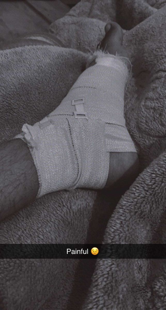 an injured man laying on top of a bed covered in blankets with bandages around his ankles