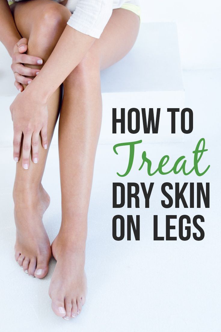 What are the causes and how to treat dry skin on legs. Skin care tips to get rid of dry skin. How to wash your legs with care, importance of eating well and removing dead cells, proper shaving and how some bad habits can affect skin dryness. #skincare #beauty #dryskin How To Get Rid Of Dry Skin On Legs Tips, How To Get Rid Of Dry Leg Skin, Scaly Legs Remedy Dry Skin, Dry Skin Leg Care Routine, Dry Skin Legs Remedies, Dry Legs Remedy How To Get Rid, Dry Body Skin Care Routine, Itchy Legs At Night, Leg Skin Care