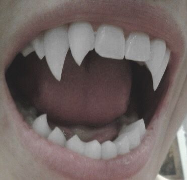 a close up of a person's mouth with teeth missing