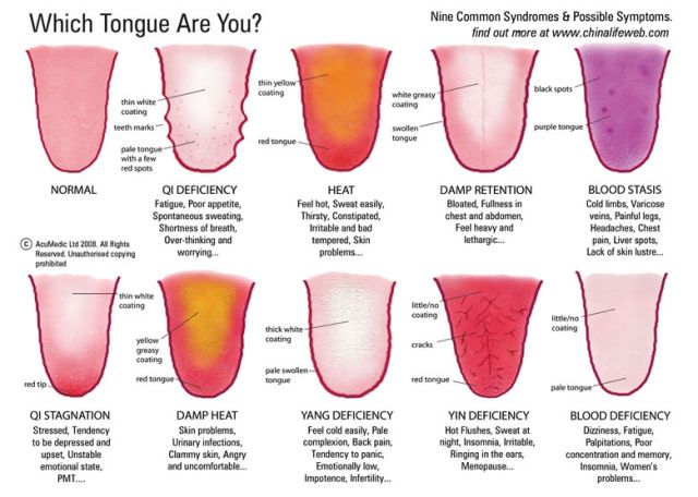 Autogenic Training, Tongue Health, Running Tips, Traditional Chinese Medicine, Reflexology, Health Info, Chinese Medicine, Acupressure, Natural Medicine