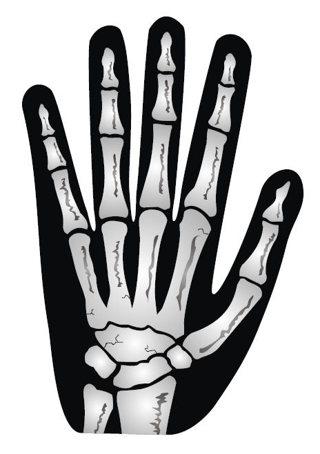 a hand with bones in the middle and fingers on each side, as if it were an x - ray