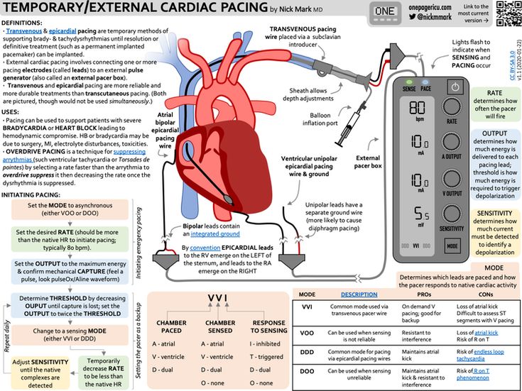 the heart is connected to an external ventilator and attached to a stethoscope