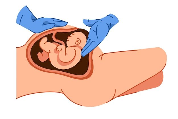 a person with blue gloves on their head is holding the baby's stomach in his hand