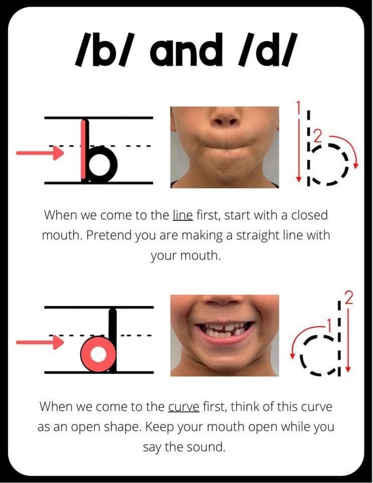 the instructions for how to use braces and teeth in different ways, including an arrow pointing