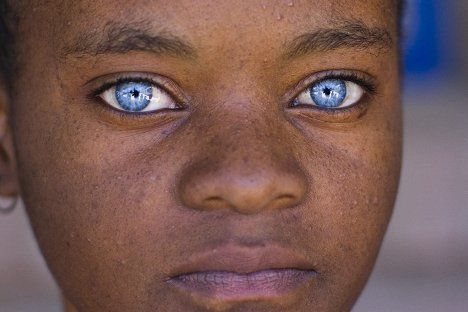 Dark skin with naturally blue eyes Black With Blue Eyes, People With Blue Eyes, Rare Eye Colors, Rare Eyes, Behind Blue Eyes, Light Eyes, Stunning Eyes, Gorgeous Eyes, Hazel Eyes