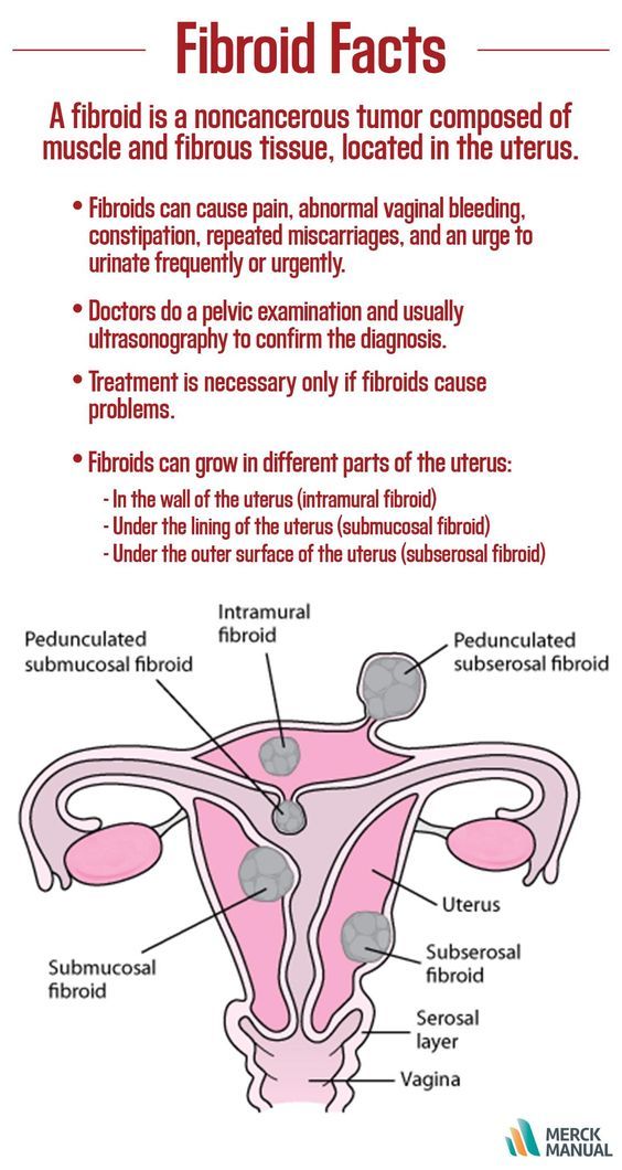 Fibroid Size Chart In Mm