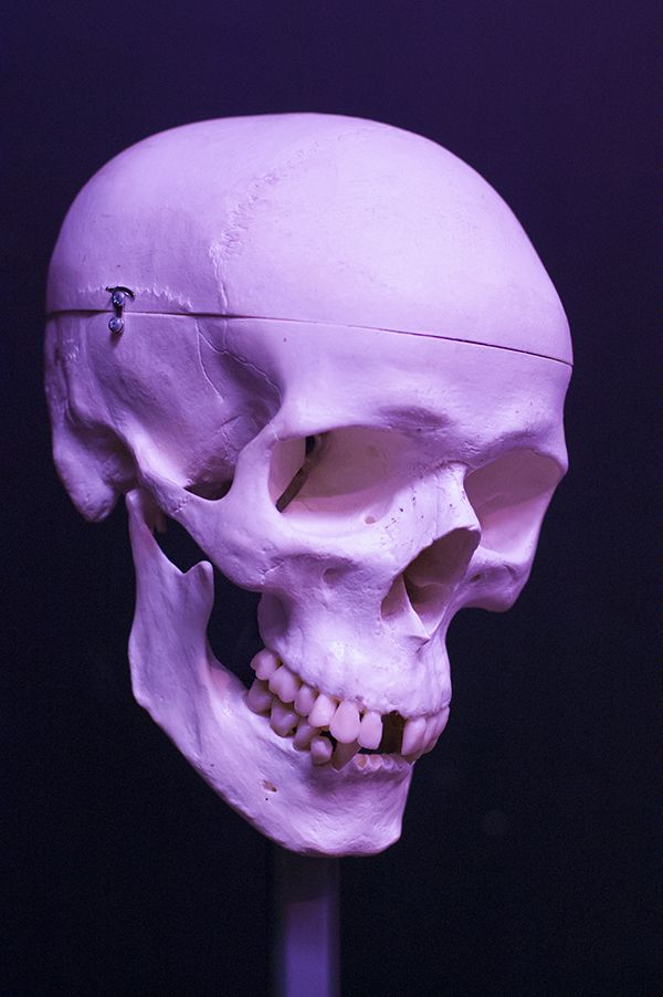 there is a fake human skull on display