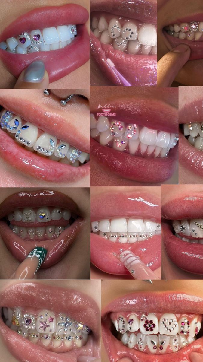 many different pictures of teeth with white and silver decorations on them, including the top one in