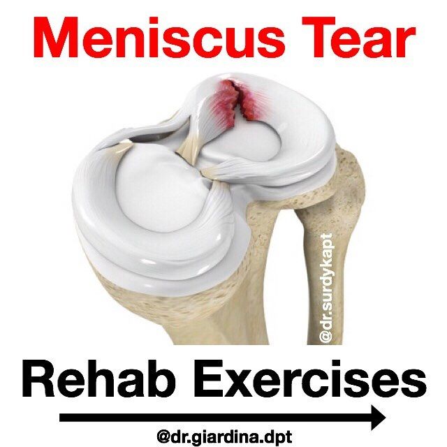 Dr. Mike Giardina DPT OCS on Instagram: “🚨MENISCUS REHAB EXERCISES🚨 - ✅ Awesome post by @dr.surdykapt from Cali. - 👉🏼The following videos (SWIPE LEFT) provide valuable exercises…” Meniscus Rehab Exercises, Collaboration Post, Stretches Exercises, Agility Workouts, Rehab Exercises, Dr Mike, Dog Bowls, Cali, Spa