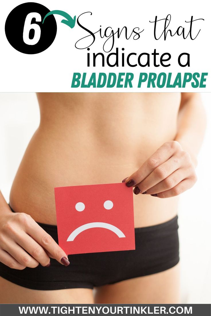 Did you know that prolapse affects 52 million women in this country?! We're sharing 6 signs to look for that may indicate you have a prolapsed bladder. We want to break it down by looking at: what it is, what it feels like, what it does to your life, plus more. Pessary For Bladder Prolapse, Prolapsed Bladder, Bladder Leakage Remedies, Bladder Prolapse, Bladder Health, Pelvic Organ Prolapse, Bladder Leakage, Bladder Control, Pelvic Floor Exercises