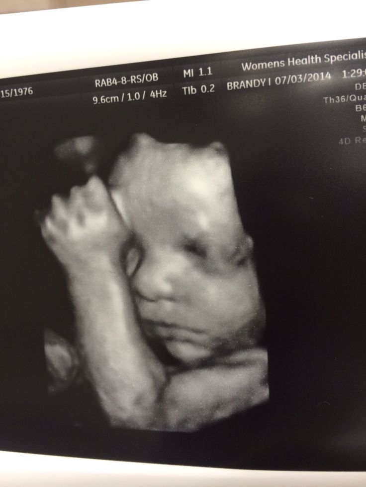 a black and white photo of a baby's feet in front of a computer screen