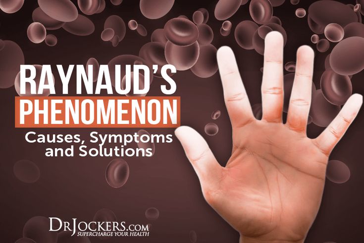 Raynaud’s Phenomenon: Causes, Symptoms and Solutions Raynauds Disease Symptoms, Reynauds Syndrome Symptoms, Raynauds Disease Remedies, Raynauds Phenomenon, Raynauds Syndrome, Reynauds Syndrome, Scleroderma Symptoms, Autoimmune Disease Symptoms, Mthfr Gene