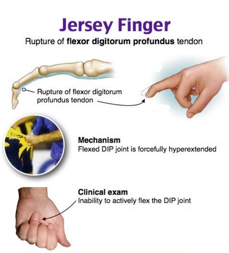 the different types of fingers and how they are used to help them understand their functions