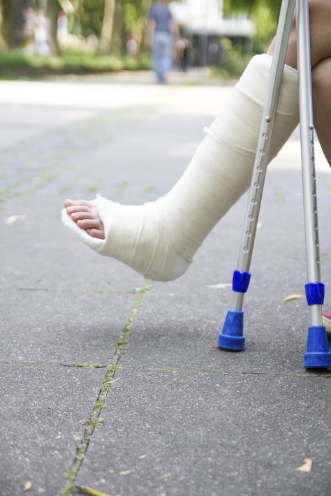 a person with crutches and a cast on their feet