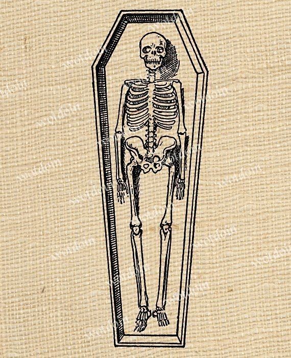 a drawing of a skeleton in a glass case on burlocked linens