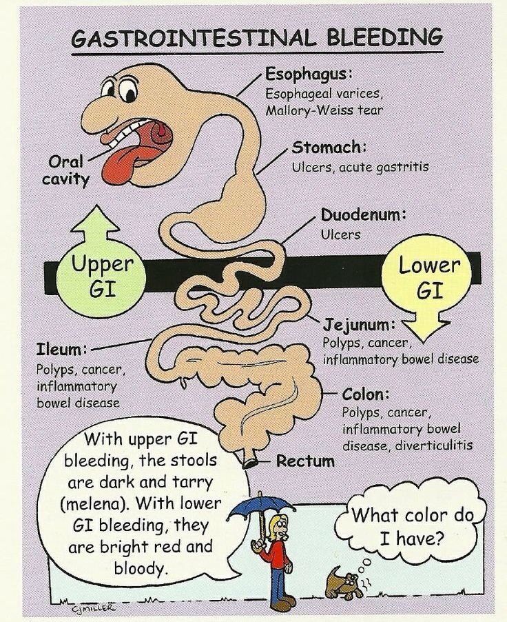 GI bleeds- paramedic nremt Paramedic School, Nursing Information, Med Surg Nursing, Nursing Mnemonics, Surgical Nursing, Medical Surgical Nursing, Nursing School Survival, Nursing School Studying, Nursing School Tips