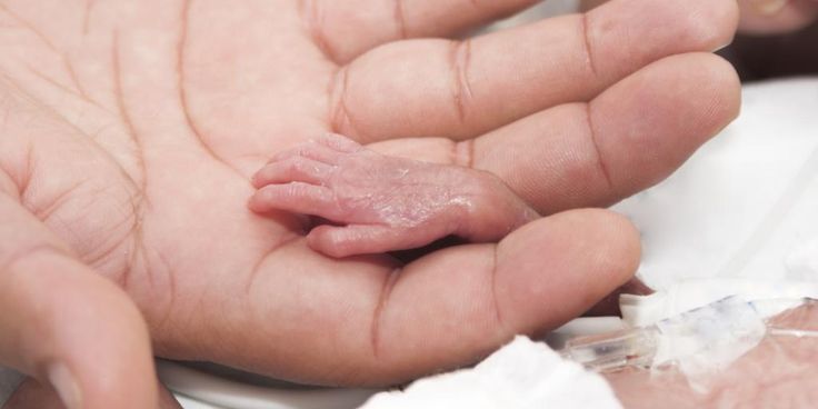 a person's hand holding a tiny animal in it's palm