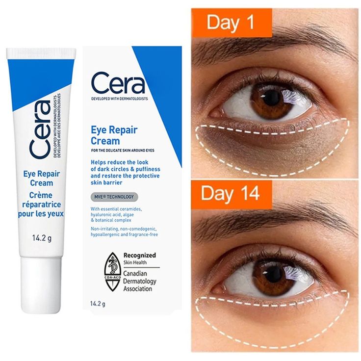 CeraVe Eye Repair Cream | Under Eye Cream For Puffiness And Bags Under Eyes | Hyaluronic Acid + Niacinamide + Marine Botanical Complex | Hydrating Eye Cream | Oil Free & Opthalmologist Tested Cerave Eye Cream, Cerave Eye Repair Cream, Eye Repair Cream, Anti Wrinkle Eye Cream, Eye Wrinkle Cream, Hydrating Eye Cream, Eye Cream For Dark Circles, Under Eye Puffiness, Dark Circles Under Eyes