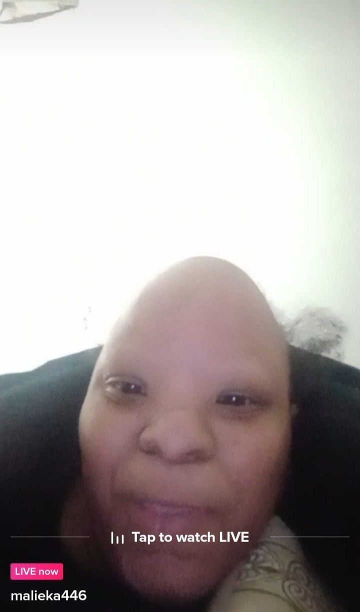 a woman with bald hair smiling at the camera