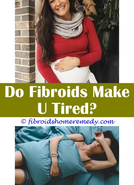 Large fibroid removal.Hysteroscopy for uterine fibroids.Is there something i can take to shrink my fibroids - Uterine Fibroids. 8707139447 #IntramuralFibroid Intramural Fibroid, Mirena Iud, Fibroid Diet, Fibroid Surgery, Fibroid Tumors, Bahasa Melayu, Surgery Recovery, Natural Treatments, Ultrasound