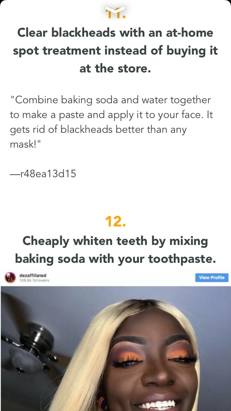 Clear Blackheads, Rid Of Blackheads, Natural Laundry, Get Rid Of Blackheads, Healthy Detox, Girl Tips, Detox Recipes, Teeth Whitening, Blackheads