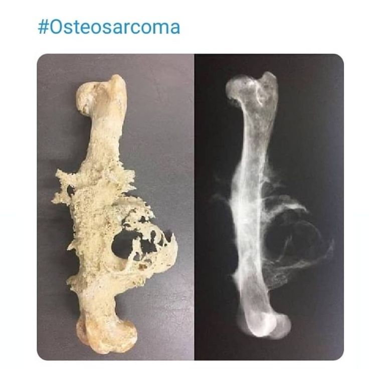 an image of two different bones in the same photo