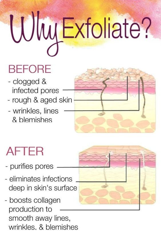 Face Tightening, Skin Facts, Pore Cleanser, Peeling Skin, Wrinkled Skin, Skin Cleanser Products, Face Skin Care, Beauty Skincare, Skin Tips