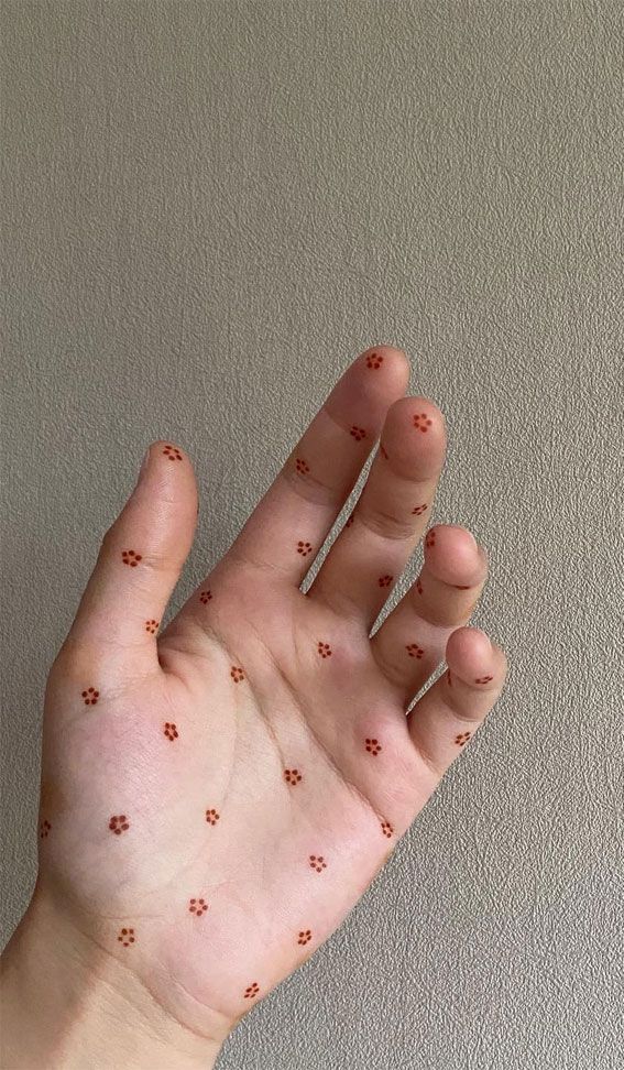 a person's hand with small brown dots on their fingers and thumbnails