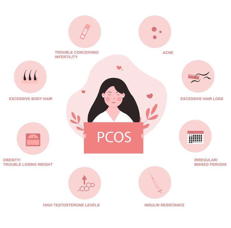 Polycystic ovary syndrome symptoms infographic High Testosterone, Polycystic Ovarian Syndrome, Healthy Lifestyle Habits, Testosterone Levels, Insulin Resistance, Women's Health, Sociology, Short Story, Vector Art