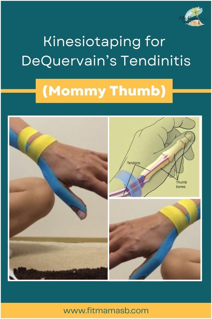 Discover the power of Kinesio taping in relieving DeQuervain's tendinitis, commonly known as "Mommy Thumb." Learn about effective taping techniques, exercises, and self-care tips to alleviate pain, improve mobility, and support your postpartum journey. Visit our website for expert guidance on tackling Mommy Thumb. Kt Tape Elbow Pain, Kt Tape For Thumb Pain, Kt Tape Carpal Tunnel, Thumb Taping, Kt Tape Thumb, Thumb Pain Relief, Physio Tape, Carpal Tunnel Exercises, Wrist Pain Relief