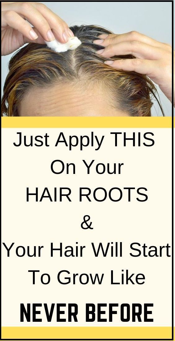 Hair Roots, Hair Remedies For Growth, Grow Long Hair, Hair Growth Serum, Hair Remedies, Hair Regrowth, Promotes Hair Growth, Roots Hair, Natural Hair Growth