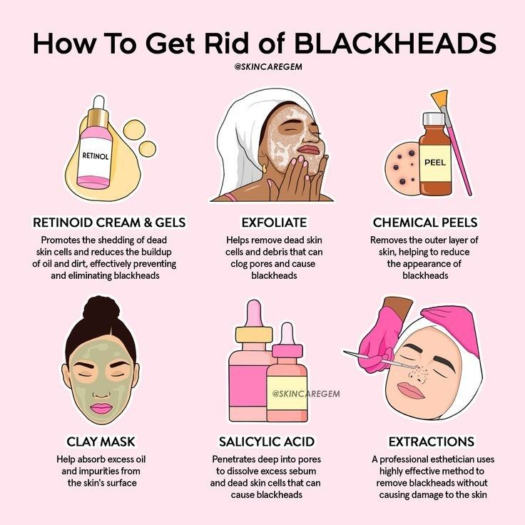 Rid Of Blackheads, Skin Advice, Skin Care Routine Order, Basic Skin Care Routine, Perfect Skin Care Routine, Get Rid Of Blackheads, Healthy Skin Tips, Facial Skin Care Routine, Body Care Routine