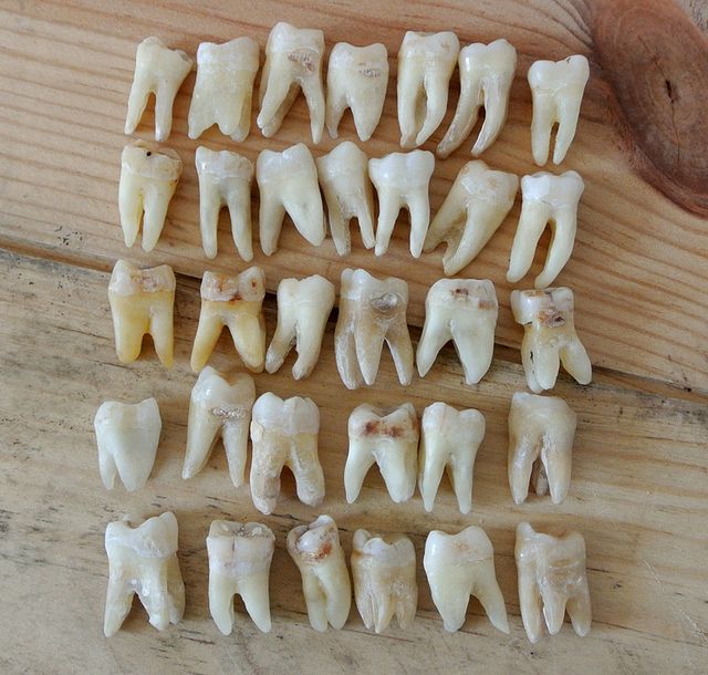 a little collection of human teeth molars Loose Tooth, Human Teeth, Dental Art, Budget Planer, Tooth Fairy, Teeth Whitening, Bones, Polymer Clay, Sketch Book