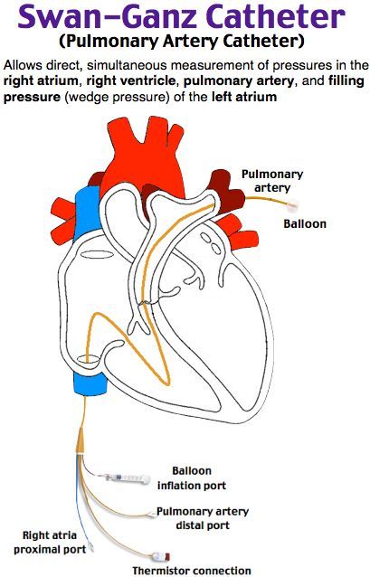 diagram of the human heart with labels on each side and labeled blood vessels attached to it