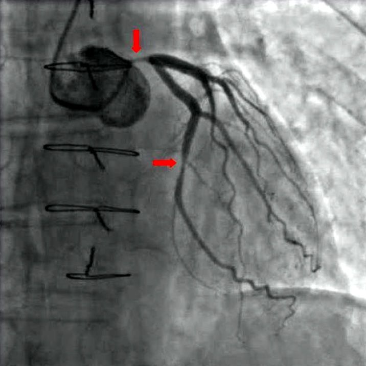 an x - ray shows the location of two branches