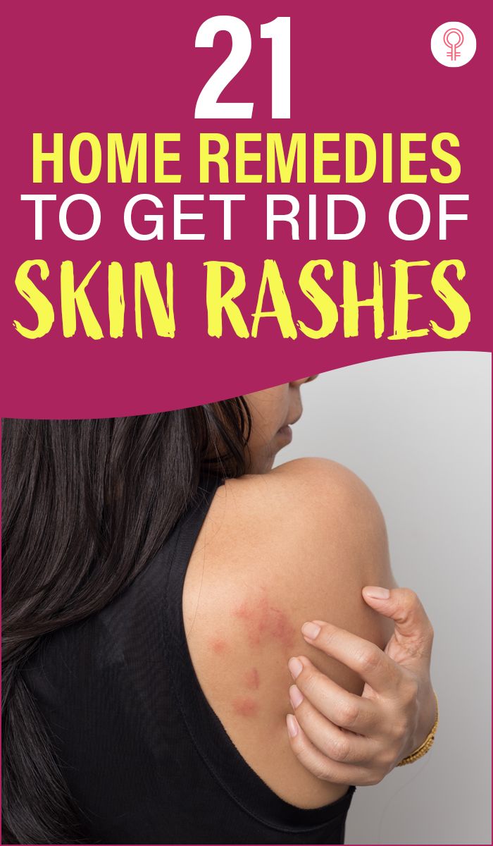 21 Home Remedies To Get Rid Of Skin Rashes: We have all had rashes at some point in our lives. They not only cause itching and pain but also put you through a lot of discomfort. While a few go away on their own, others take time. Skin rashes could also be a result of a more serious underlying skin condition – another reason to steer clear of them. Are there any natural remedies for rashes? Keep reading to find out. #skincare #skincaretips #skinrashes #remedies #homeremedies Itching Skin Remedies, Natural Rash Remedies, Essential Oils For Rash, Face Rash Remedies, Skin Rash On Face, Skin Rash Remedies, Home Remedies For Rashes, Itching Remedies, Types Of Skin Rashes