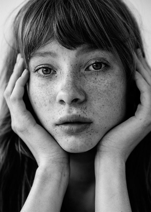 a black and white photo of a woman with freckled hair holding her hands to her face