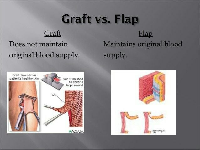 Medical Study, Skin Grafting, Family Nurse Practitioner, Study Essentials, Future Doctor, Medical Studies, Nurse Practitioner, Primary Care, Plastic Surgery