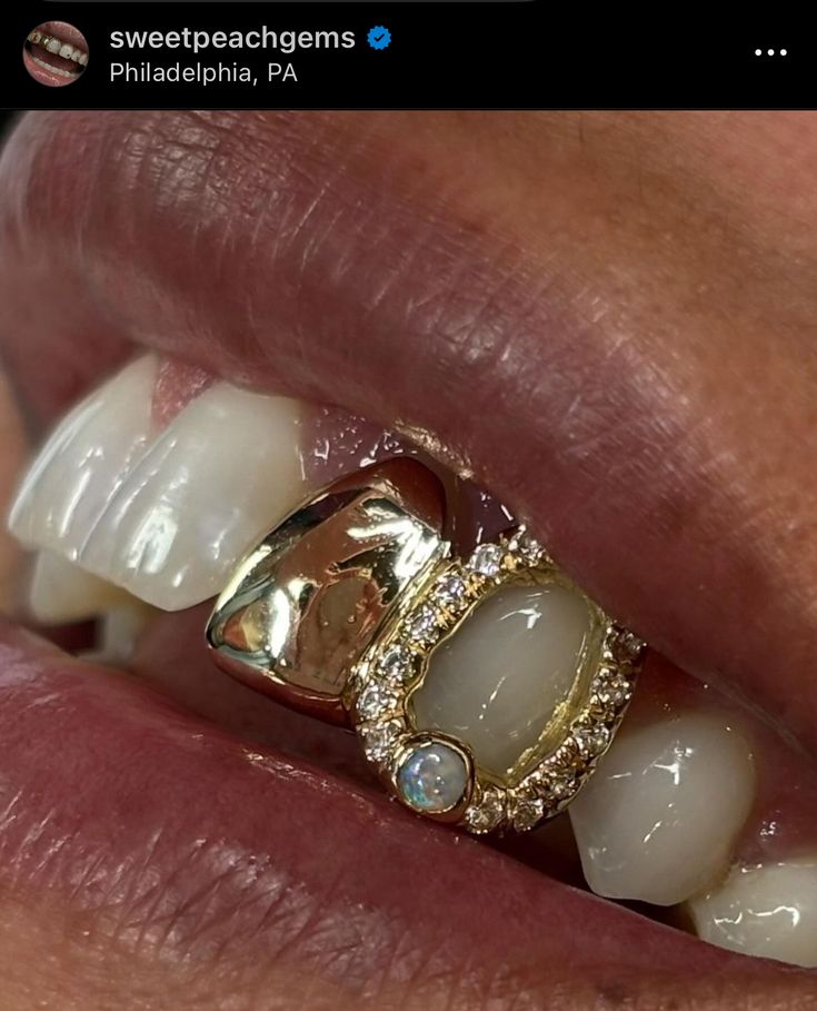 Grills Teeth Fangs, Front Tooth Grill, Colorful Grillz, Grills For Gap Teeth, Two Tooth Grillz, Women’s Grills, Bottom Grillz For Women, Grillz For Females Aesthetic, Letter Grillz