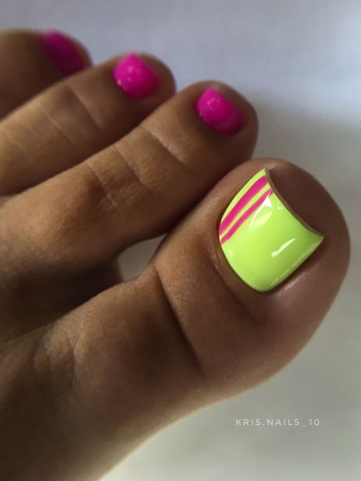 Easy Toenail Painting Ideas, August Pedicure Ideas, Neon Pedicure Ideas, Neon Toe Nails Summer, Neon Yellow Toes, Neon Toenails, Neon Pedicure Toenails, Kids Pedicure Ideas, Tropical Toe Nail Designs