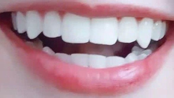 Fang Teeth Natural Aesthetic, Fang Teeth Aesthetic, Teeth With Natural Fangs, Lips Claims For Dr, Lip Claims For Dr, Eyelash Claims For Dr, Natural Vampire Teeth, Natural Fangs Teeth, Teeth Fangs Natural